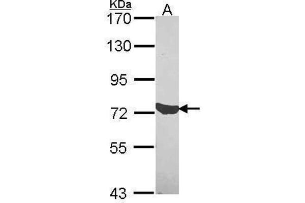 C1S anticorps