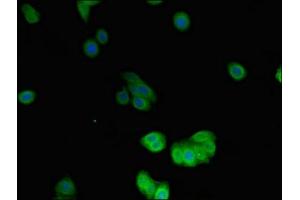Immunofluorescent analysis of HepG2 cells using ABIN7149764 at dilution of 1:100 and Alexa Fluor 488-congugated AffiniPure Goat Anti-Rabbit IgG(H+L) (Desmin antibody  (AA 2-86))