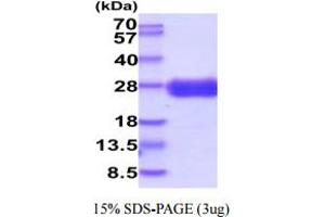 SDS-PAGE (SDS) image for CD7 (CD7) (AA 26-180) protein (His tag) (ABIN5854880) (CD7 Protein (CD7) (AA 26-180) (His tag))