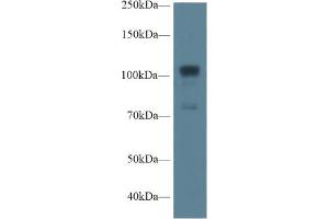 Western Blot; Sample: Human A549 cell lysate; Primary Ab: 1µg/ml Rabbit Anti-Rat NOS1 Antibody Second Ab: 0. (NOS1 antibody  (AA 468-616))