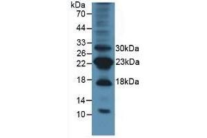 Detection of Surv in Mouse Lung Tissue using Polyclonal Antibody to Survivin (Surv) (Survivin antibody  (AA 1-140))