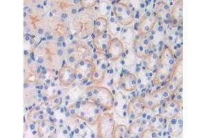 Used in DAB staining on fromalin fixed paraffin- embedded kidney tissue (Abcd2 antibody  (AA 501-695))