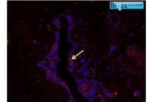 Image was kindly submitted by Erica Pimenta from UMDNJ. (CXCL13 antibody  (AA 23-109))