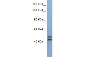 Host:  Rabbit  Target Name:  TEX10  Sample Type:  Fetal Brain lysates  Antibody Dilution:  1. (TEX10 antibody  (Middle Region))