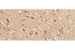 Immunohistochemistry of paraffin-embedded Human brain tissue using BATF Polyclonal Antibody at dilution of 1:45(x200) (BATF antibody)