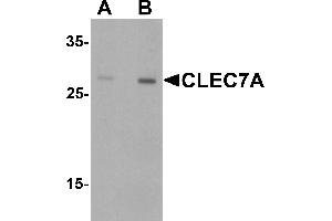 Western blot analysis of CLEC7A in rat spleen tissue lysate with CLEC7A antibody at (A) 1 and (B) 2 ugg/. (CLEC7A antibody  (Middle Region))