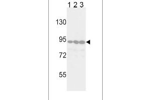 Western blot analysis of TYRO10 Antibody in Jurkat(lane 1), 293(lane 2) and Hela(lane 3) cell line lysates (35ug/lane) (DDR2 antibody)