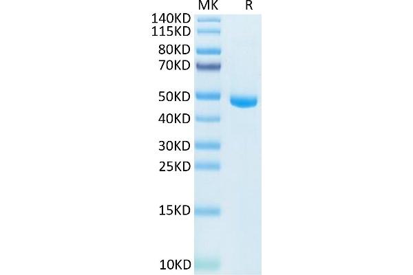 IL-20 Protein (AA 25-176) (Fc Tag)