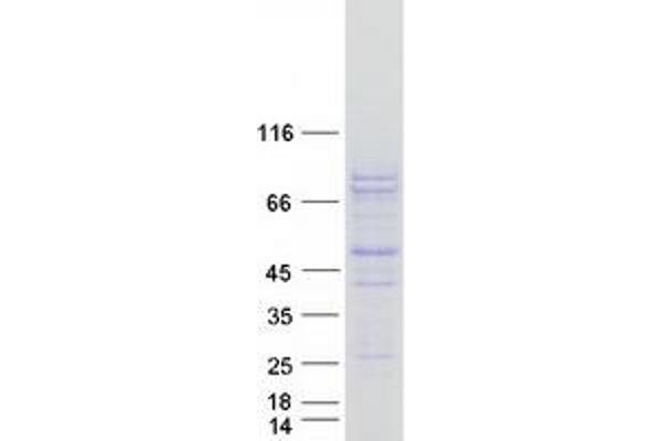 PCSK2 Protein (Myc-DYKDDDDK Tag)