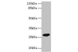 Western blot All lanes: ADIPOQ antibody at 2 μg/mL + Recombinant Adiponectin protein 0. (ADIPOQ antibody  (AA 18-240))