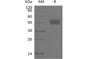 Western Blotting (WB) image for CD38 protein (Biotin,His-Avi Tag) (ABIN7319793) (CD38 Protein (Biotin,His-Avi Tag))