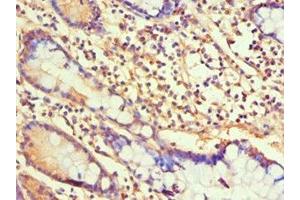 Immunohistochemistry of paraffin-embedded human small intestine tissue using ABIN7155346 at dilution of 1:100 (Histone H1-Like (LOC107807853) (AA 1-194) antibody)