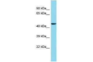 Host: Rabbit Target Name: FAM222A Sample Type: 293T Whole Cell lysates Antibody Dilution: 1. (FAM222A antibody  (N-Term))