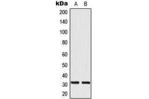 Western blot analysis of MRPL24 expression in HeLa (A), HepG2 (B) whole cell lysates. (MRPL24 antibody  (Center))