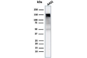 Western Blot Analysis of A431 cell lysate using EGFR-Monospecific Mouse Monoclonal Antibody (rGFR/1667). (Recombinant EGFR antibody)