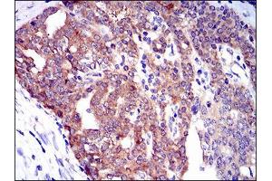 Immunohistochemistry (IHC) image for anti-Twinfilin, Actin-Binding Protein 1 (TWF1) (AA 335-384) antibody (ABIN1098116)