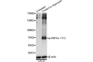 Western blot analysis of extracts of C2C12 cells, using Phospho-PRKAA1-T183/PRKAA2-T172 antibody (ABIN2988253) at 1/2000 dilution. (PRKAA1 antibody  (pThr172, pThr183))