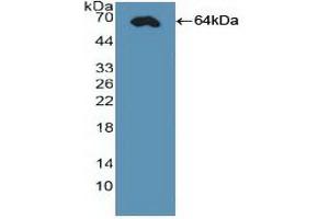 Detection of Recombinant CDX2, Human using Polyclonal Antibody to Caudal Type Homeobox 2 (CDX2) (CDX2 antibody  (AA 1-313))