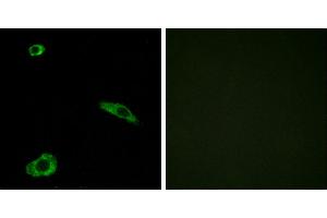 Peptide - +Western blot analysis of extracts from HeLa cells, using ACTHR antibody. (MC2R antibody  (Internal Region))