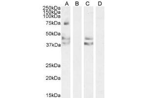 ABIN190902 (0. (Angiotensin II Type-1 Receptor antibody  (Internal Region))