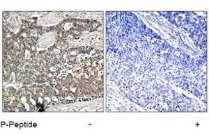 Image no. 3 for anti-DOK2 (DOK2) (pTyr299) antibody (ABIN197044) (DOK2 antibody  (pTyr299))