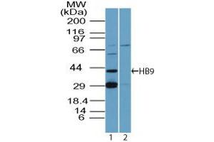 HB9 Western Blot. (MNX1 antibody)