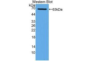 Western blot analysis of the recombinant protein. (XDH antibody  (AA 1-300))