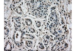 Immunohistochemical staining of paraffin-embedded breast tissue using anti-MAPK1 mouse monoclonal antibody. (ERK2 antibody)