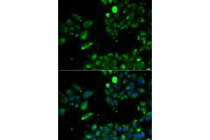 Immunofluorescence analysis of U2OS cells using UQCRFS1 antibody (ABIN5974112). (UQCRFS1 antibody)