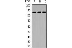 Western blot analysis of KDM1A expression in Jurkat (A), MCF7 (B), mouse testis (C) whole cell lysates. (LSD1 antibody)