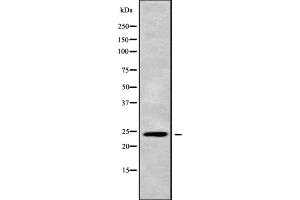 Western blot analysis APOBEC3H using A549 whole cell lysates. (APOBEC3H antibody)