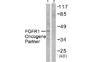 Western blot analysis of extracts from HepG2 cells, using FGFR1 Oncogene Partner antibody (#C0190). (FGFR1OP antibody)