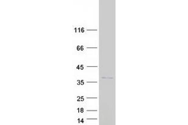 SKA1 Protein (Transcript Variant 2) (Myc-DYKDDDDK Tag)