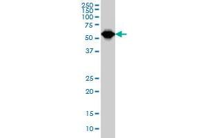 TCF3 monoclonal antibody (M01A), clone 5G2 Western Blot analysis of TCF3 expression in Hela S3 NE . (TCF3 antibody  (AA 545-654))