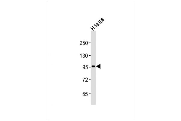 USP13 antibody  (AA 389-419)