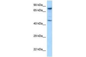 Image no. 1 for anti-SKI-Like Oncogene (SKIL) (AA 542-591) antibody (ABIN6748077) (SKIL antibody  (AA 542-591))