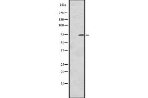 Western blot analysis of CNNM1 expression in Human tonsil tissue lysate,The lane on the left is treated with the antigen-specific peptide. (Cyclin M1 antibody  (Internal Region))