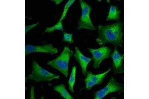 Immunofluorescent analysis of NF-kappaB p65 staining in Hela cells. (NF-kB p65 antibody)