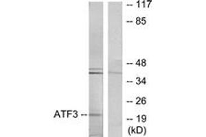 Western Blotting (WB) image for anti-Activating Transcription Factor 3 (ATF3) (AA 131-180) antibody (ABIN2889413) (ATF3 antibody  (AA 131-180))
