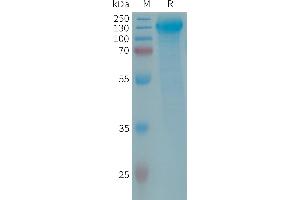 Human Protein, His Tag on SDS-PAGE under reducing condition. (GPR64 Protein (AA 38-627) (His tag))