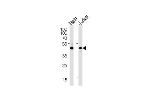 PTGDR antibody