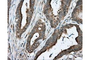 Immunohistochemical staining of paraffin-embedded liver tissue using anti-PRKAR2A mouse monoclonal antibody. (PRKAR2A antibody)