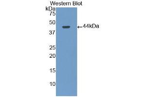 Western blot analysis of the recombinant protein. (Gastrin antibody  (AA 1-101))