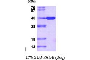 SDS-PAGE (SDS) image for Aldo-Keto Reductase Family 1, Member C3 (3-alpha Hydroxysteroid Dehydrogenase, Type II) (AKR1C3) (AA 1-323) protein (His tag) (ABIN666747) (AKR1C3 Protein (AA 1-323) (His tag))