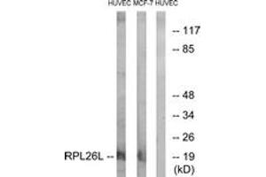 Western blot analysis of extracts from HuvEc/MCF-7 cells, using RPL26L Antibody. (RPL26L antibody  (AA 96-145))