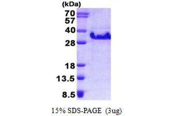 FXYD5 Protein (His tag)