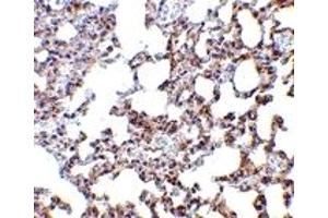 Immunohistochemistry (IHC) image for anti-SKI-Like Oncogene (SKIL) (N-Term) antibody (ABIN1031579) (SKIL antibody  (N-Term))