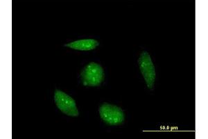 Immunofluorescence of purified MaxPab antibody to RAG2 on HeLa cell. (RAG2 antibody  (AA 1-527))