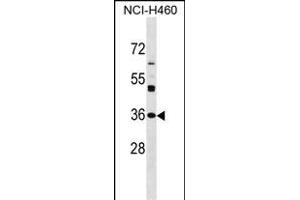 NAT6 antibody  (AA 150-179)