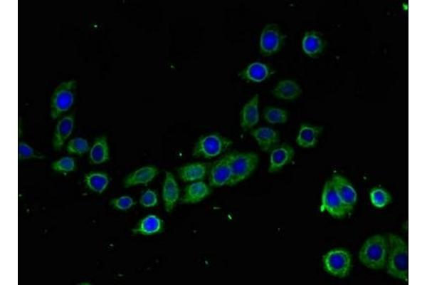 TMIGD2 antibody  (AA 23-150)